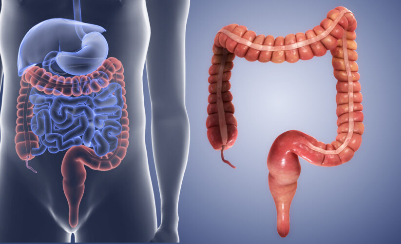 Kalın Bağırsak Hastalıkları