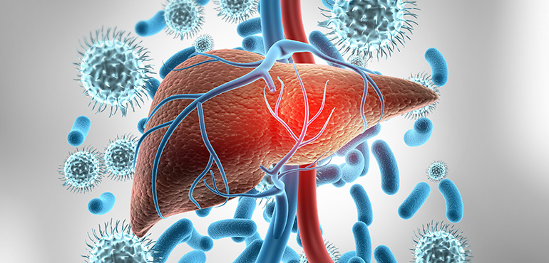 Akut ve Kronik Hepatitler Nedir? Tedavi Yöntemleri Nelerdir?