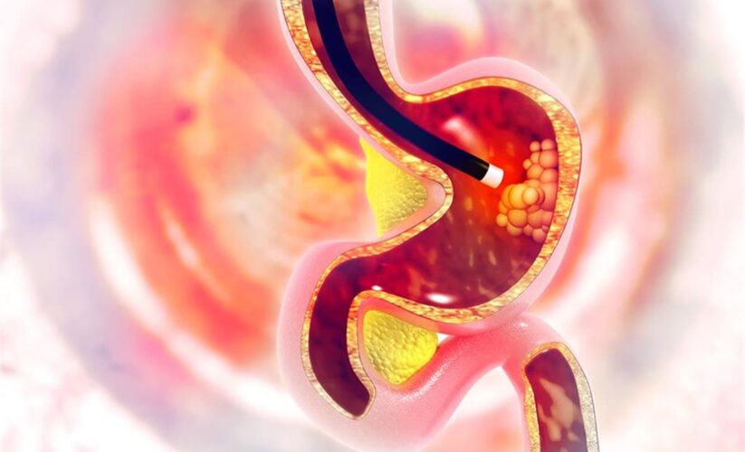 Endoskopi Nasıl Yapılır