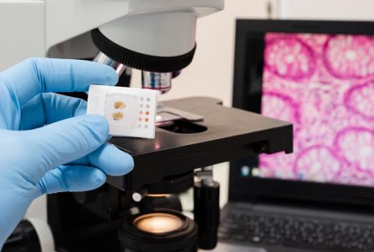 patoloji-belirtileri