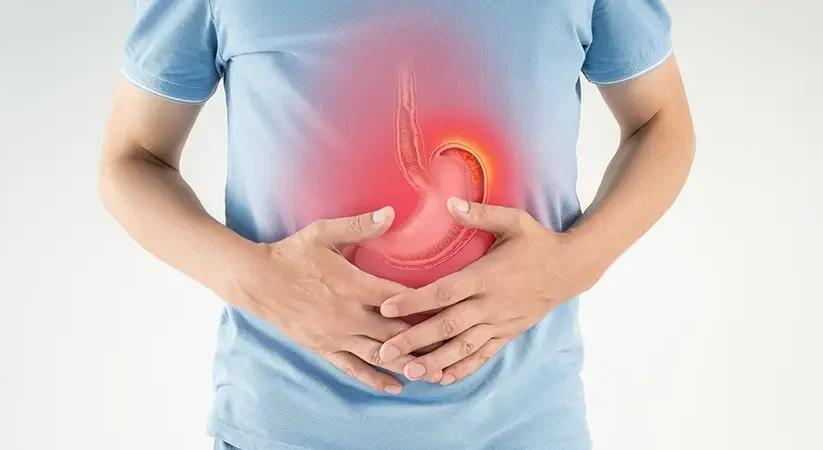 Ülser Nedir? Nasıl Geçer?