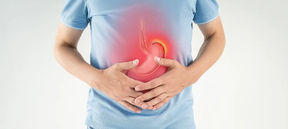 Ülser Nedir? Nasıl Geçer?